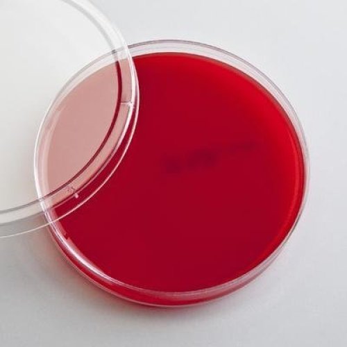 Blood agar